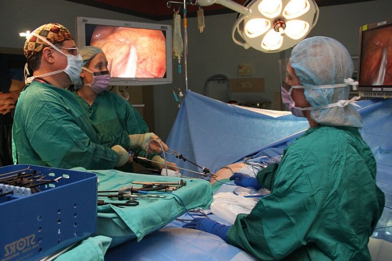 kirurgija za prostatitis