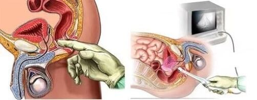Instrumentalna dijagnoza prostatitisa